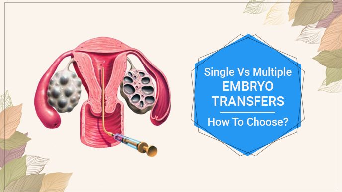 Single Vs Multiple Embryo Transfers How to choose?