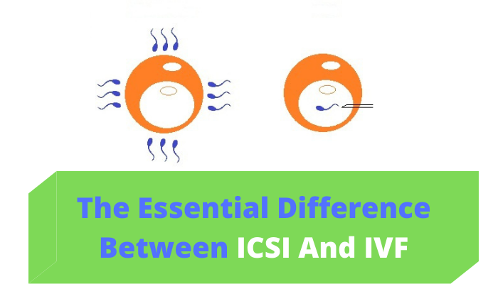 ICSI and IVF difference
