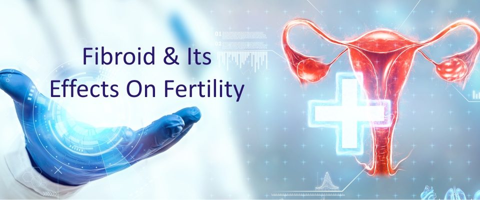 Fibroid & its Effects on Fertility