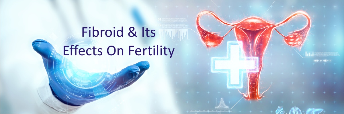 Fibroid & its Effects on Fertility